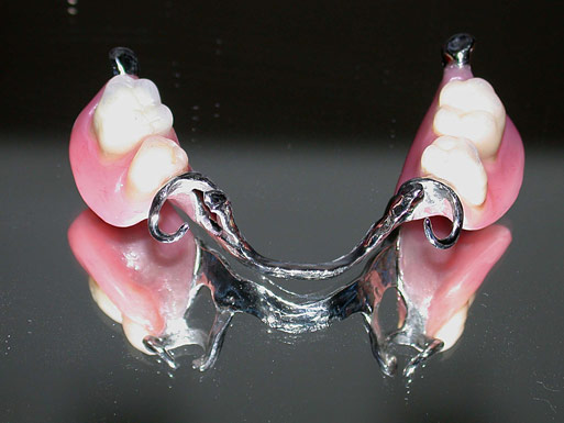 Protesi-Mobili-Impianti-1