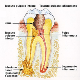 endodonzia