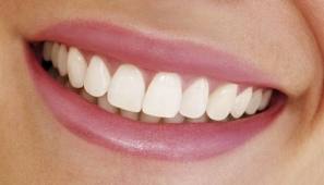estetica dentale