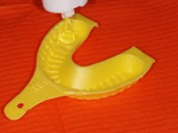 fluoroprofilassi